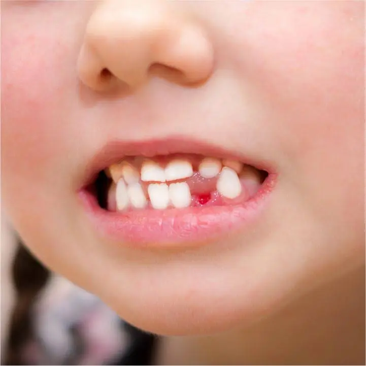 Precious Smiles Children & Family Dentistry