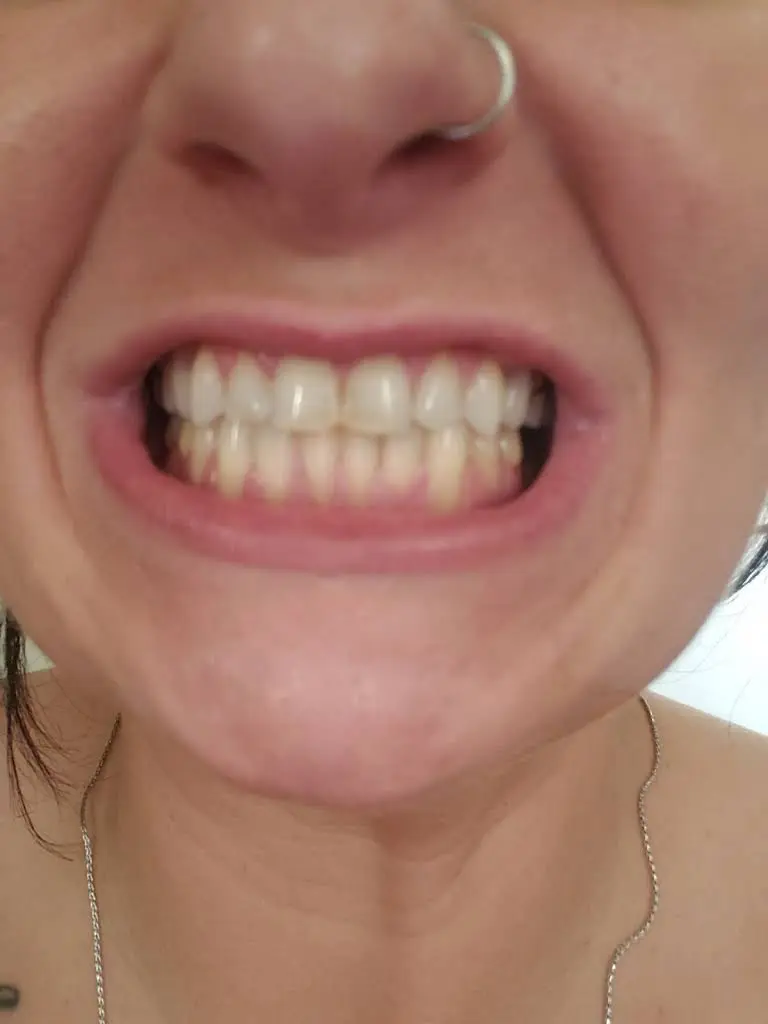 Pristine Smiles Family Dentistry