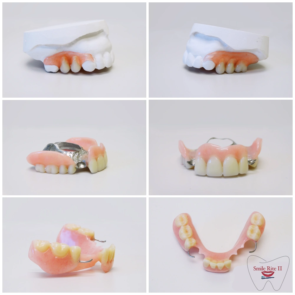 Smile Rite II