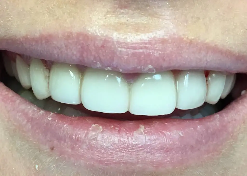 Summit View DDS