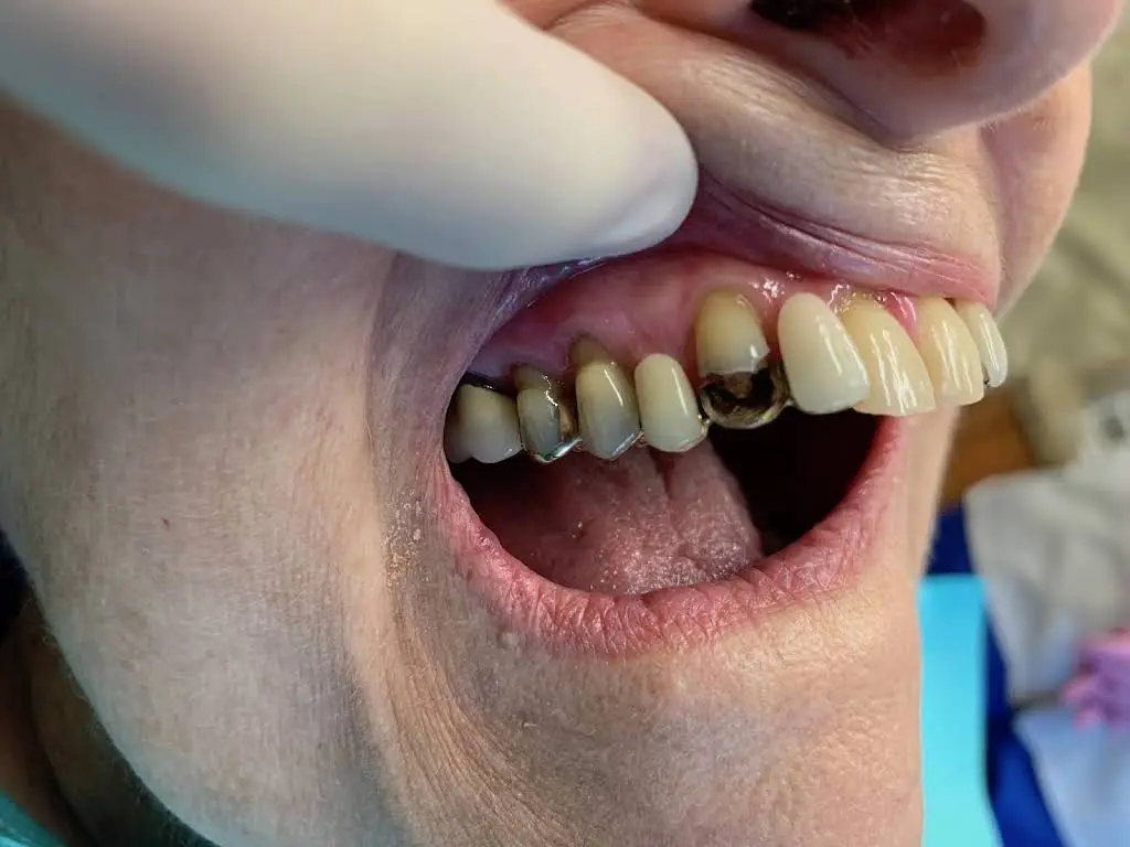 Virginia Family Dentistry Mechanicsville