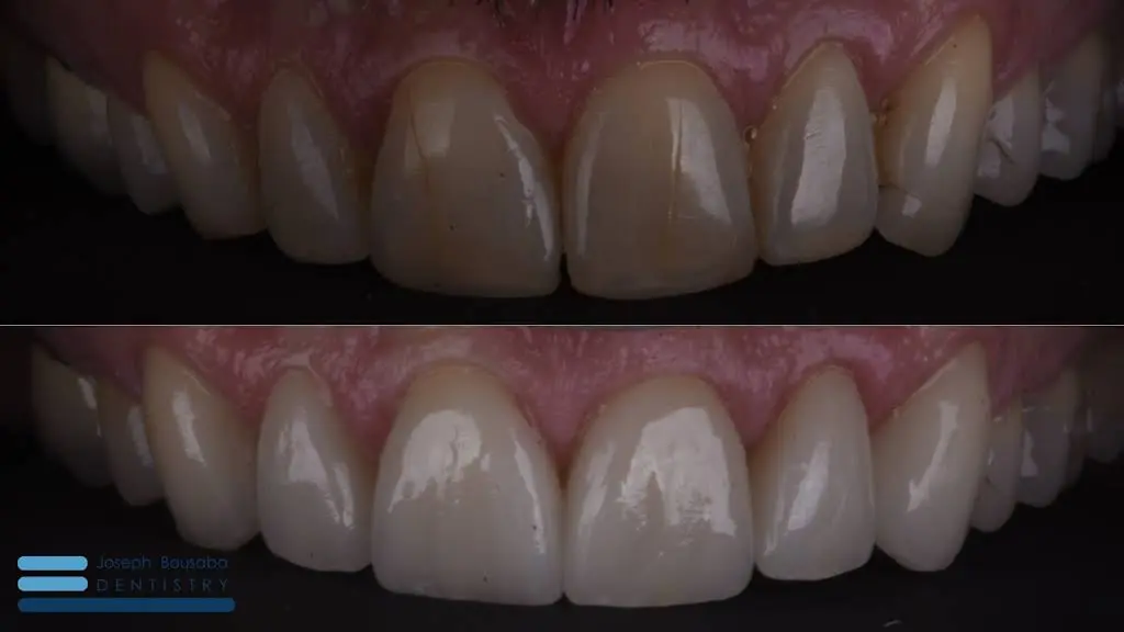 Joseph Bousaba Dentistry