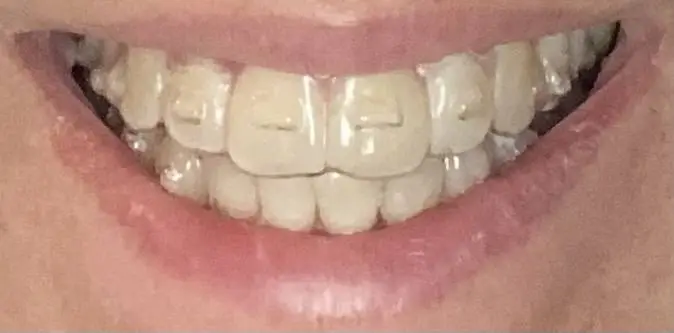 RVA Dental Care
