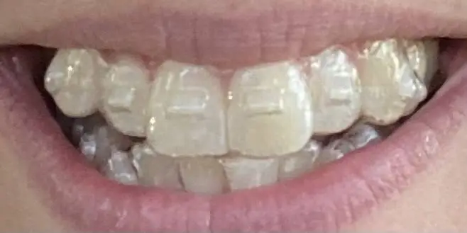 RVA Dental Care