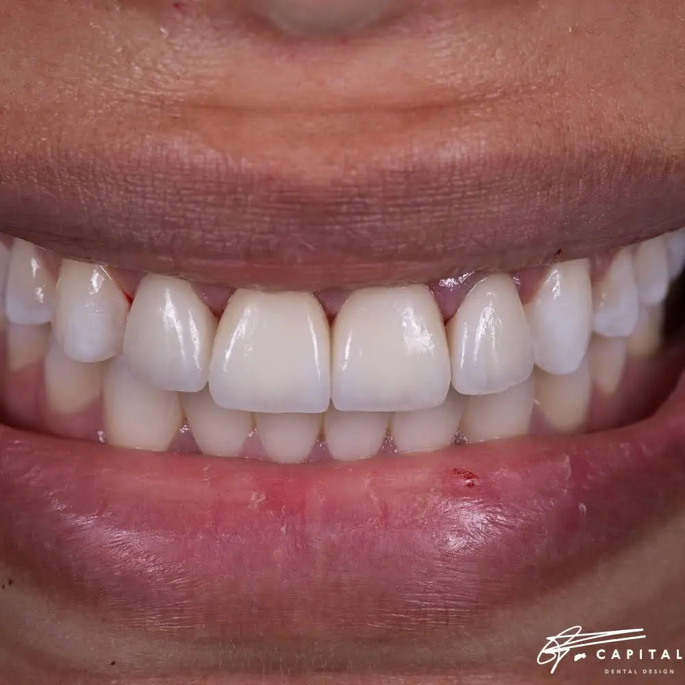 Capital Dental Design