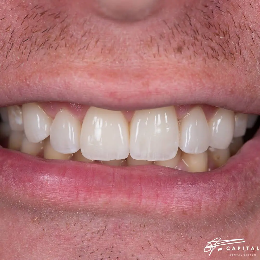 Capital Dental Design