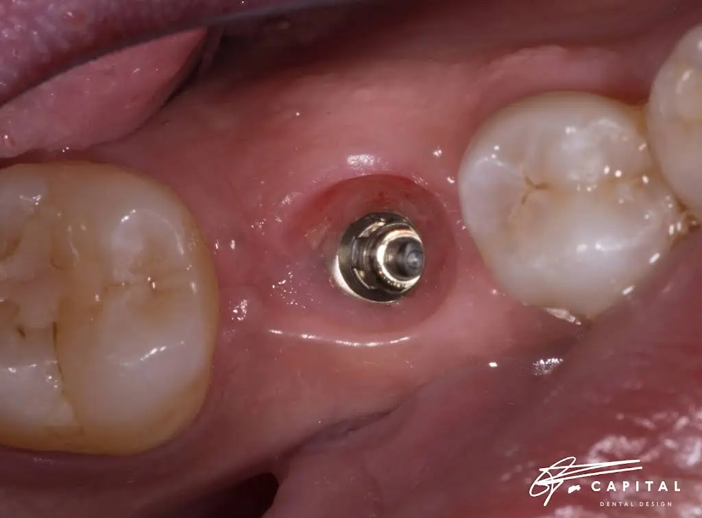 Capital Dental Design