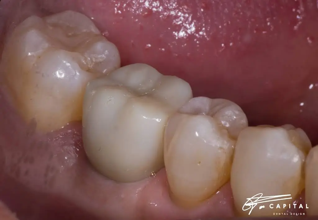 Capital Dental Design