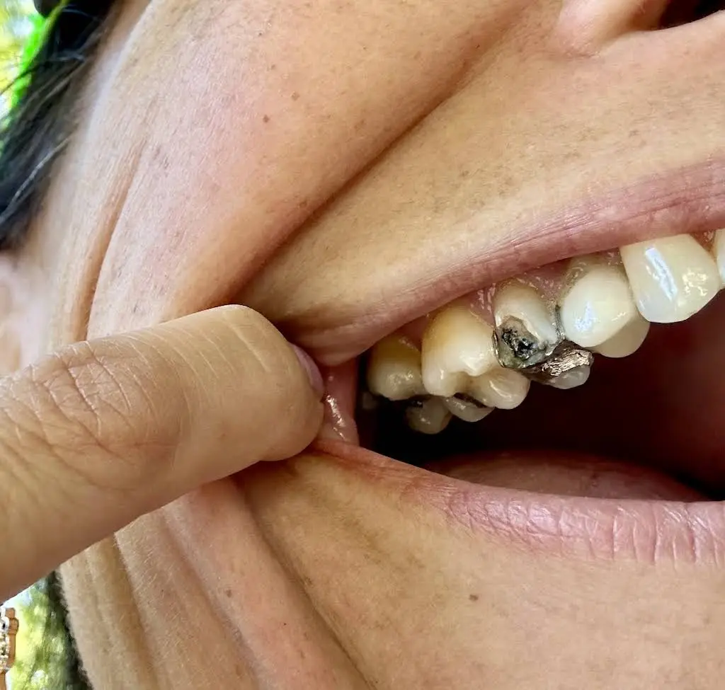 Central Avenue Dental