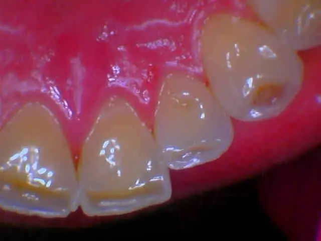 Gentry Dental