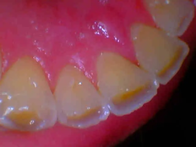 Gentry Dental