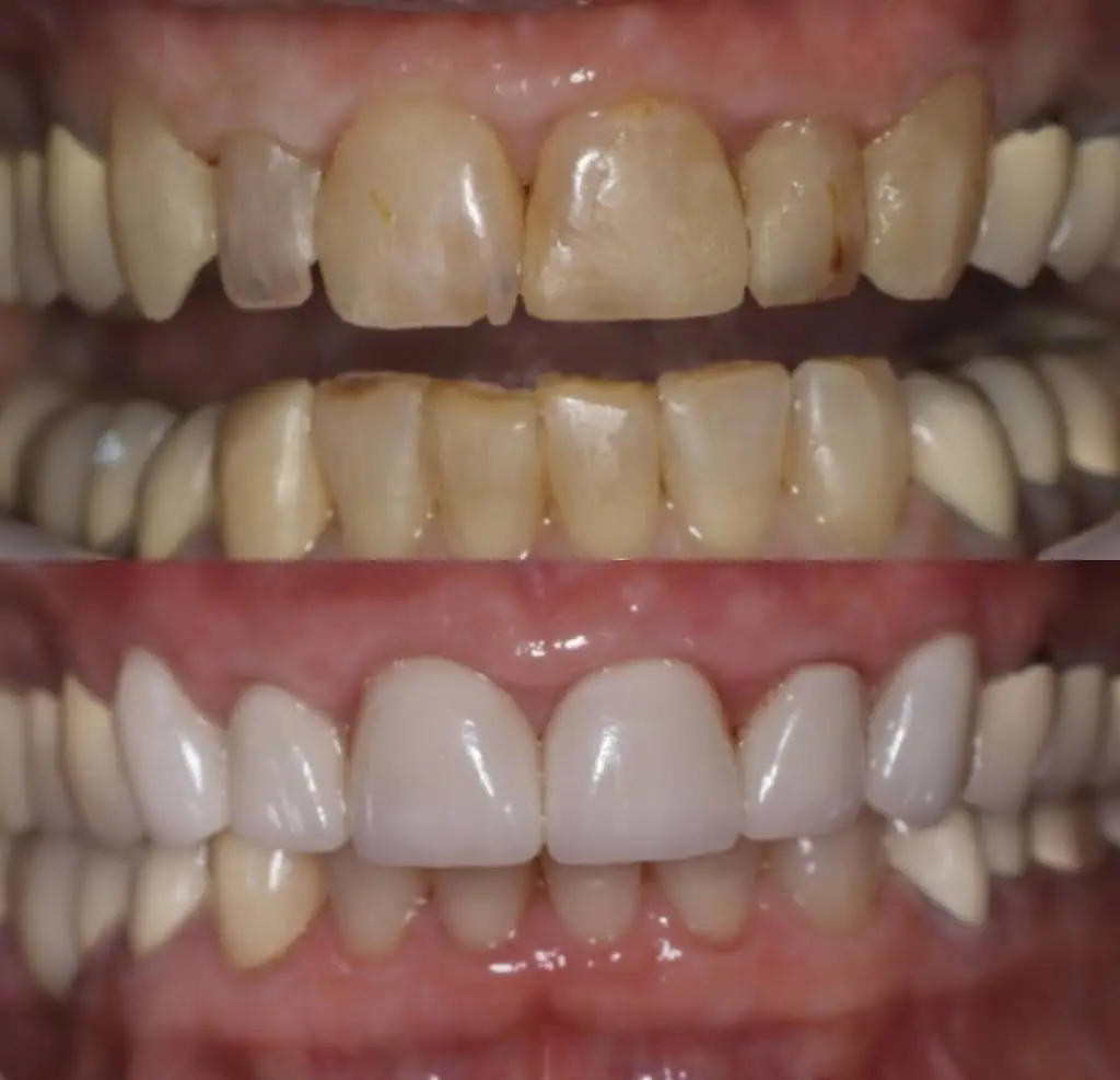 Linganore Dental