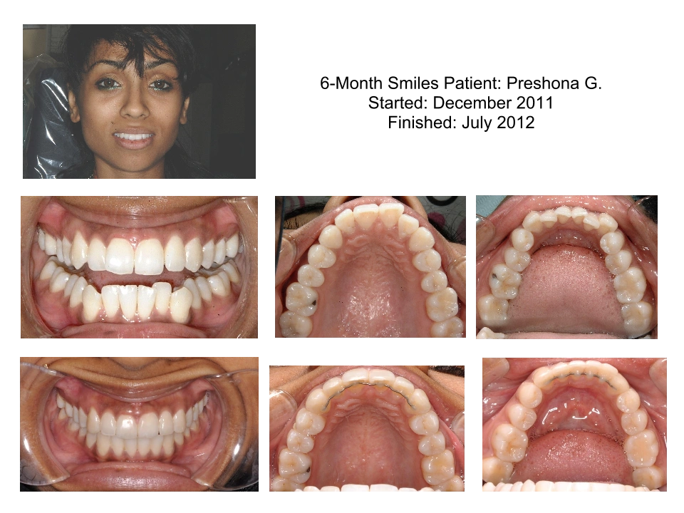 Howard County Family Dentistry