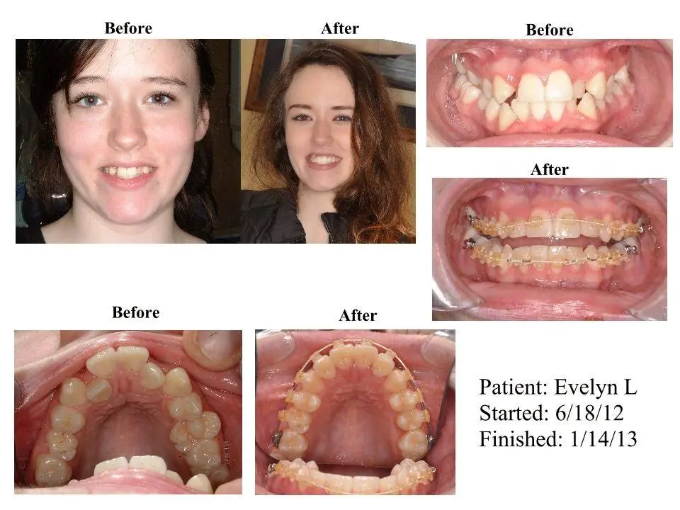 Howard County Family Dentistry