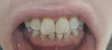 United Smiles
