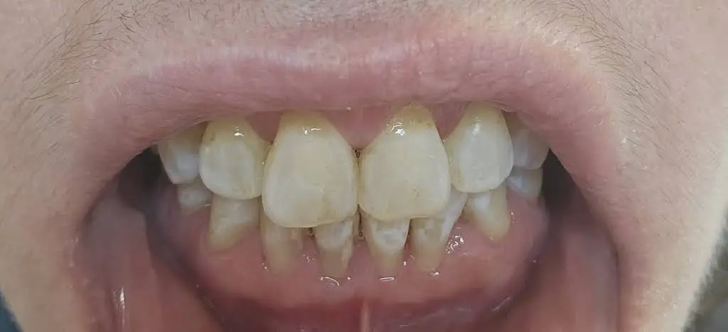 United Smiles