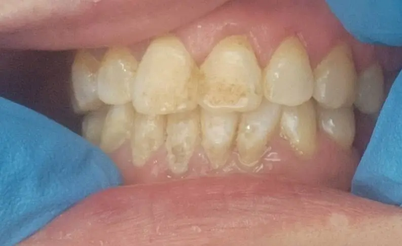 United Smiles