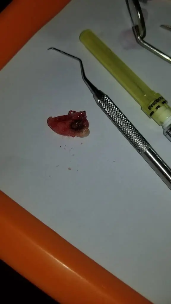 Ideal Dental Care