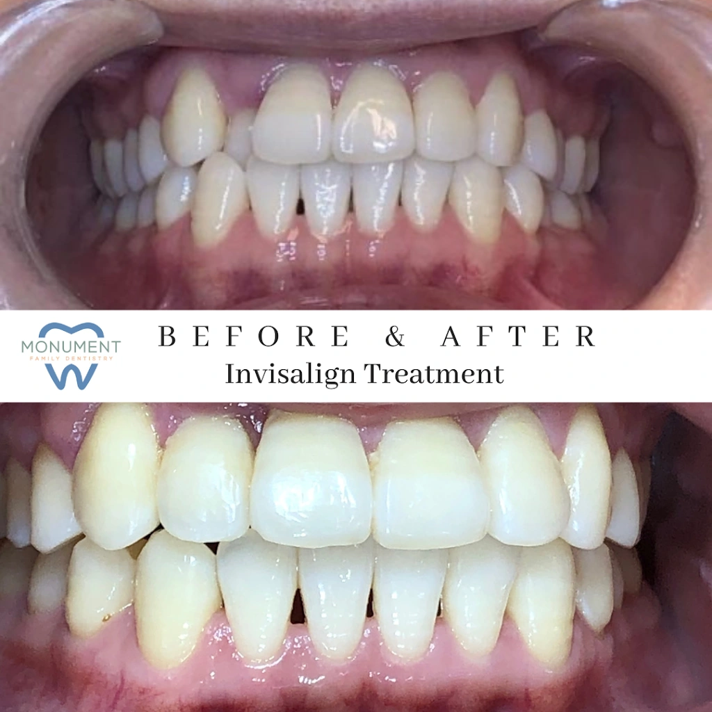Monument Family Dentistry