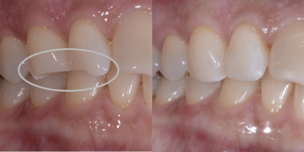 Porter Dental Group