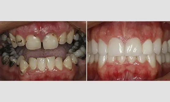 Charlotte Center for Cosmetic Dentistry