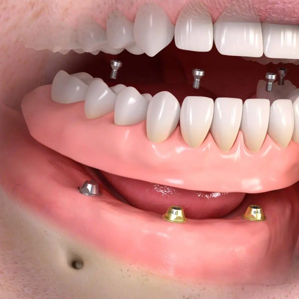 Charlotte Center for Cosmetic Dentistry