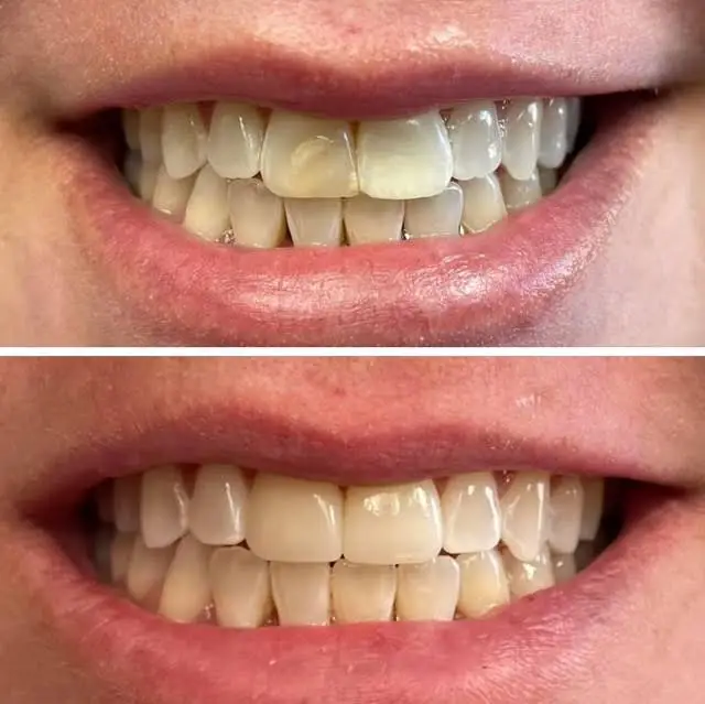 Allen Prevette DDS PA