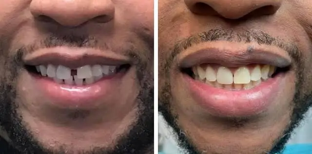 Allen Prevette DDS PA