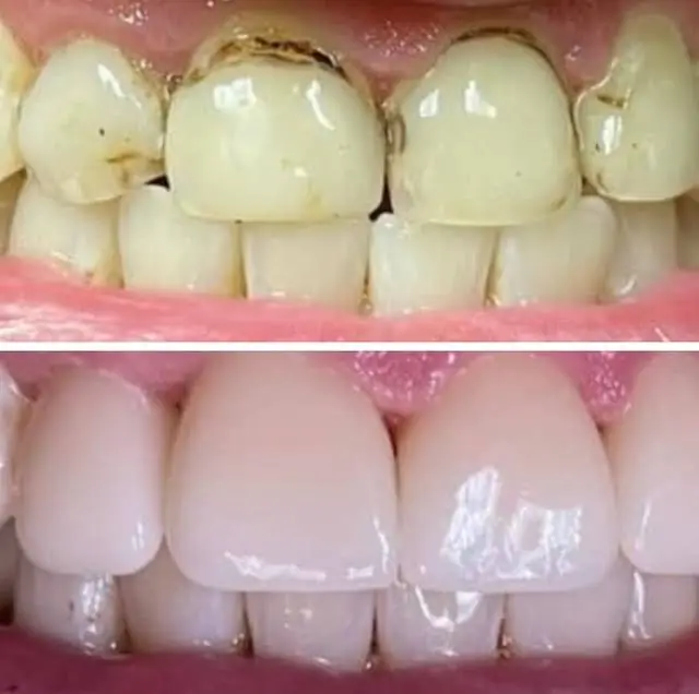 Allen Prevette DDS PA
