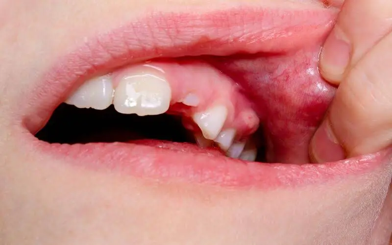 Monahan Family and Cosmetic Dentistry