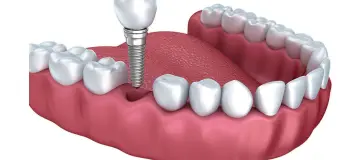 PearlFection Dentistry - Urbana