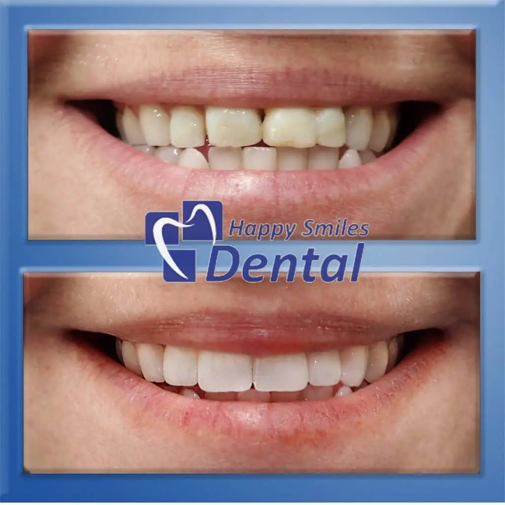 Happy Smiles Dental