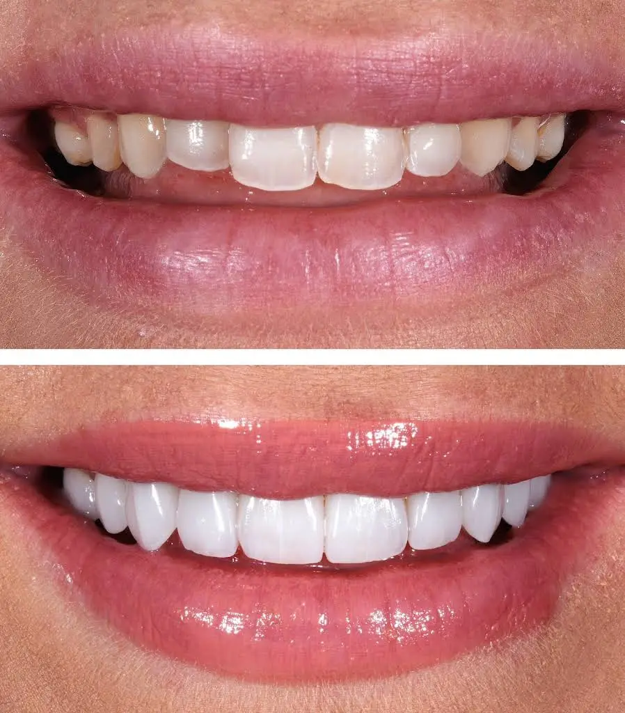 Clarksburg Dental Care