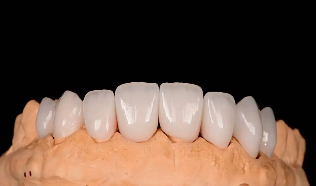 Clarksburg Dental Care