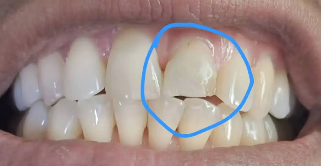 Clarksburg Dental Care