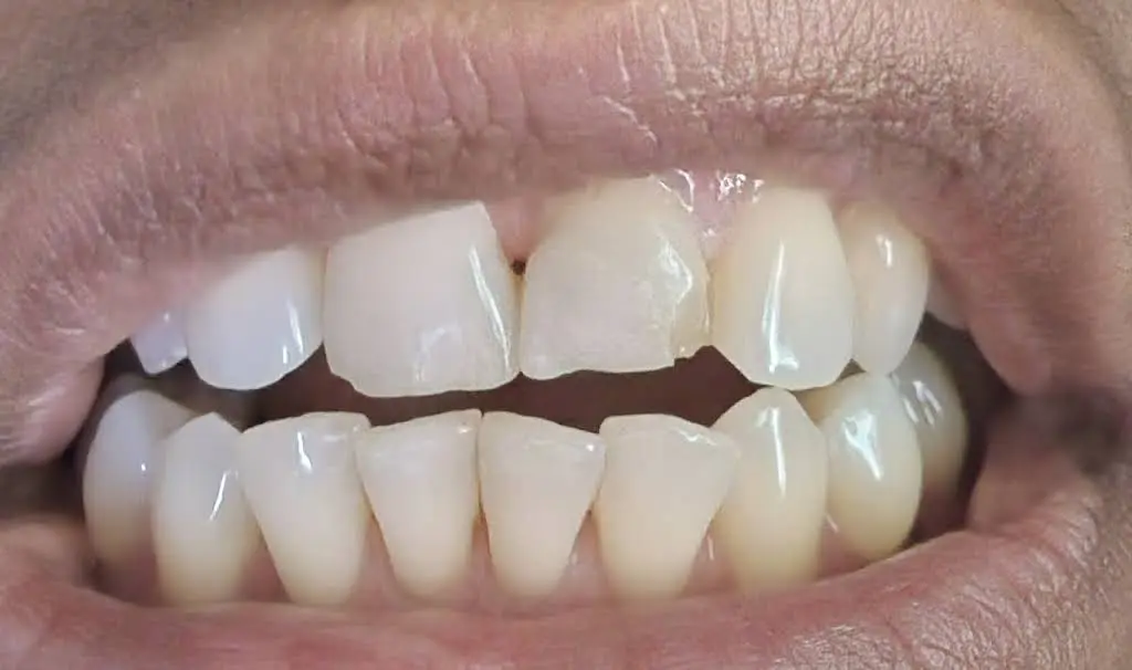 Clarksburg Dental Care