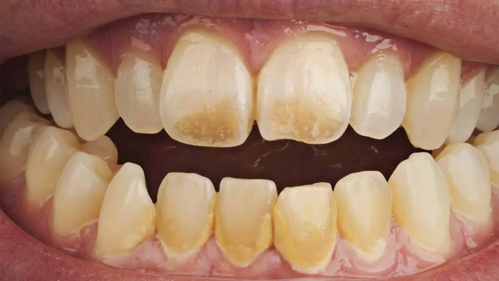 Clarksburg Bright Smiles Dental Office