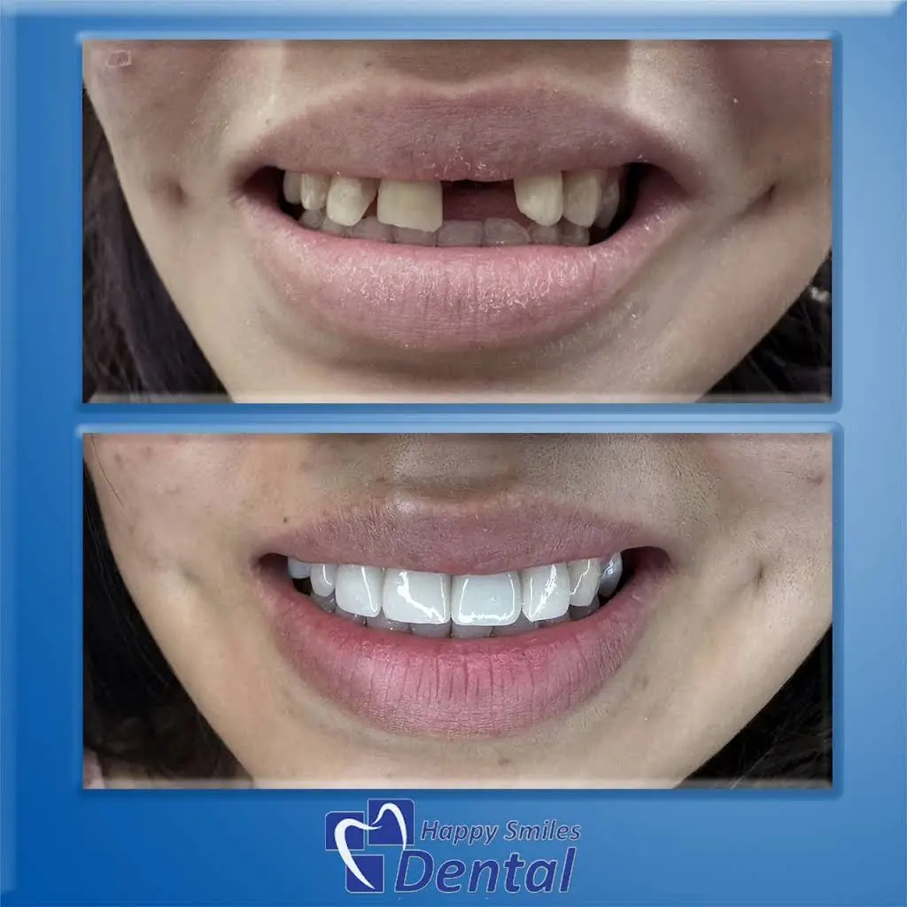 Happy Smiles Dental Clarksburg