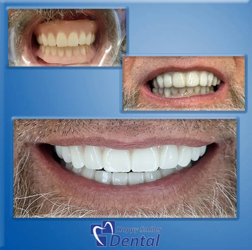 Happy Smiles Dental Clarksburg