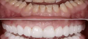 Laytonsville Family Dentistry - Dr. Harith Ali