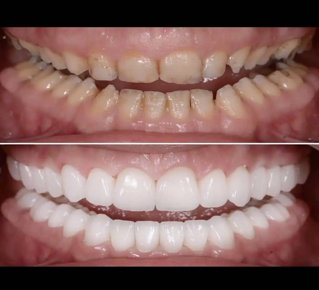 Laytonsville Family Dentistry - Dr. Harith Ali