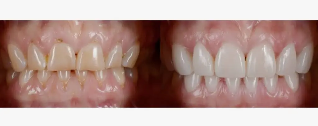 Laytonsville Family Dentistry - Dr. Harith Ali
