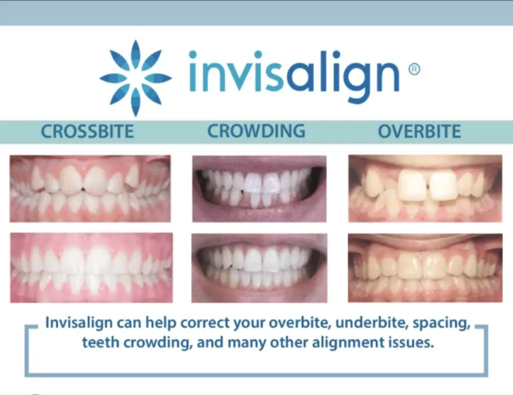Laytonsville Family Dentistry - Dr. Harith Ali