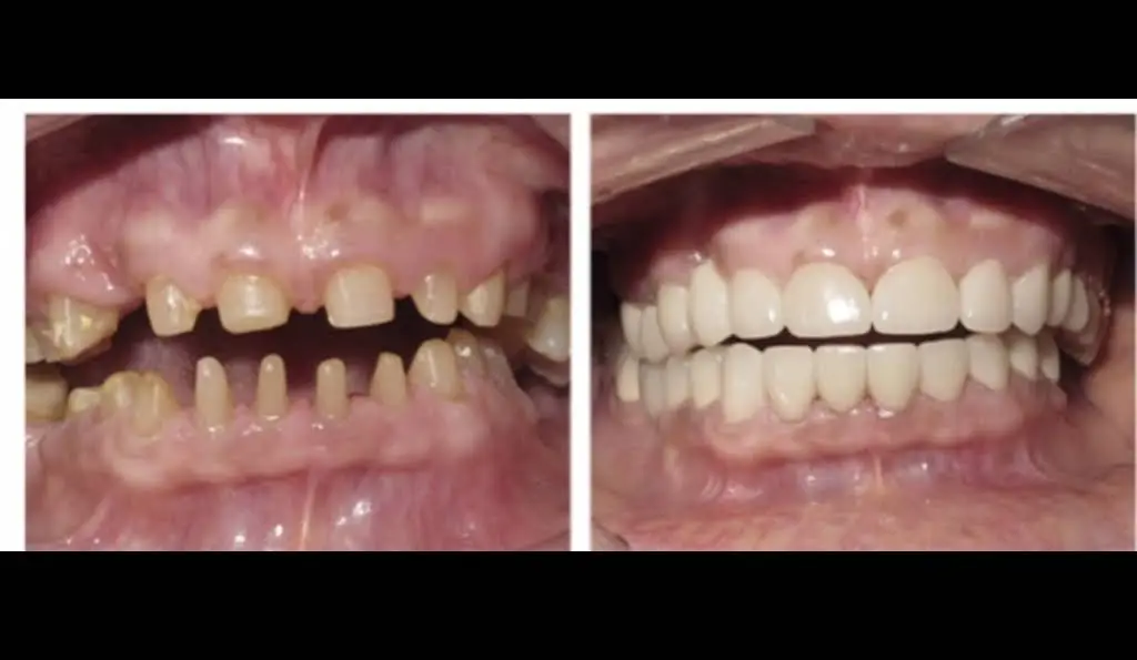 Laytonsville Family Dentistry - Dr. Harith Ali