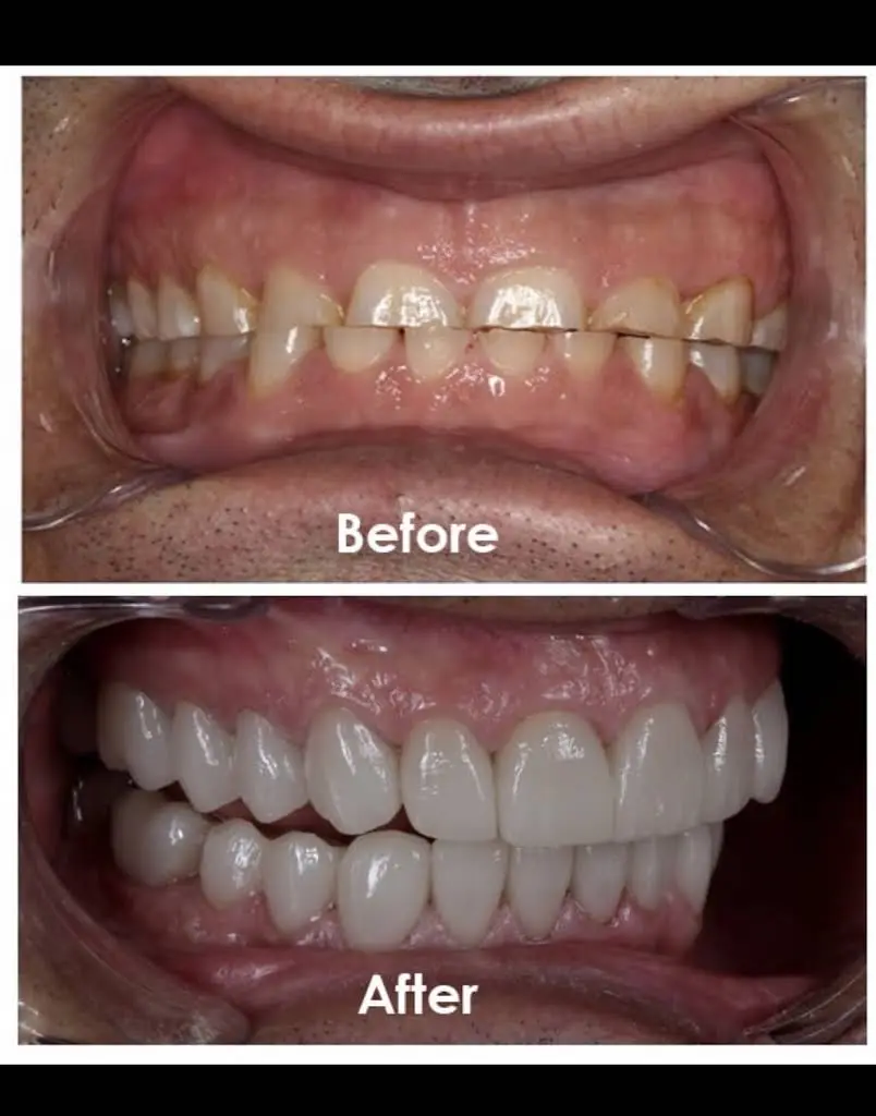 Laytonsville Family Dentistry - Dr. Harith Ali
