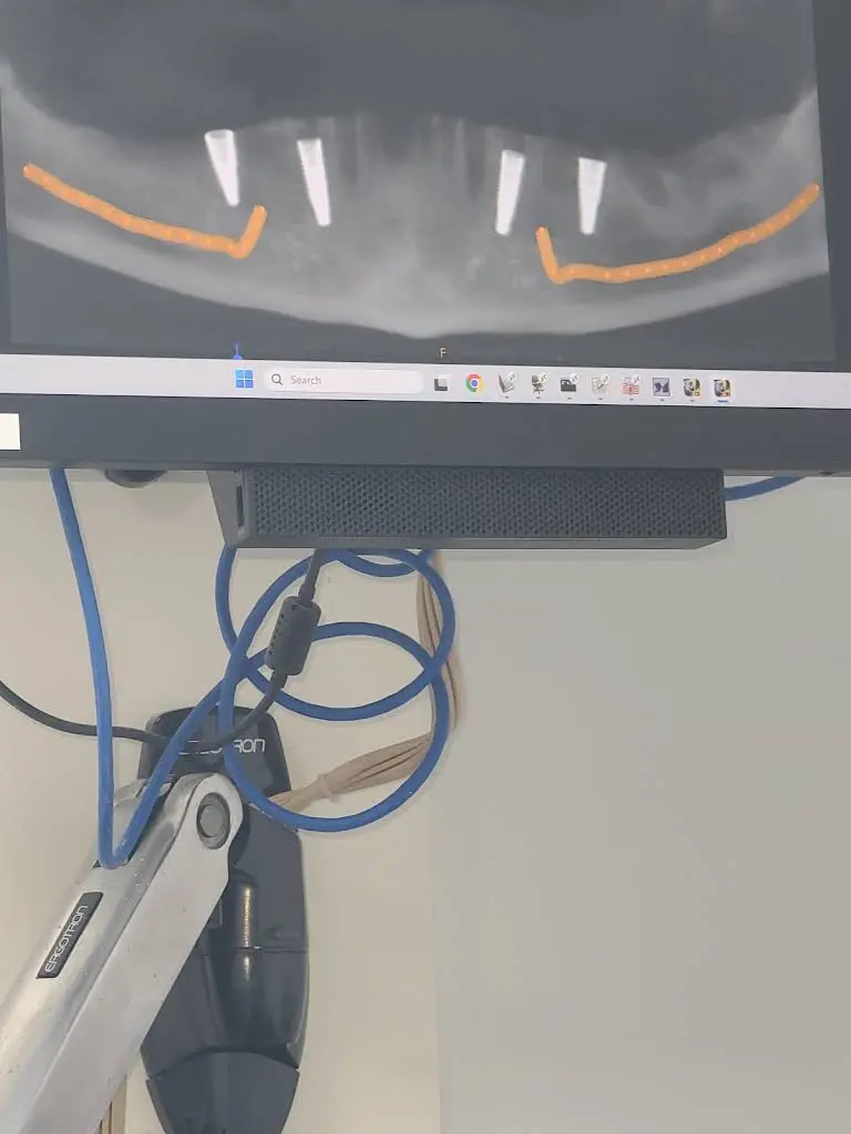 Affordable Dentures & Implants