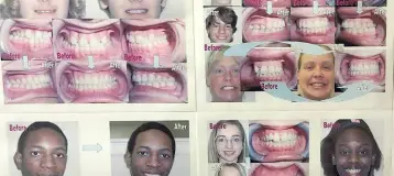 Ji Orthodontics