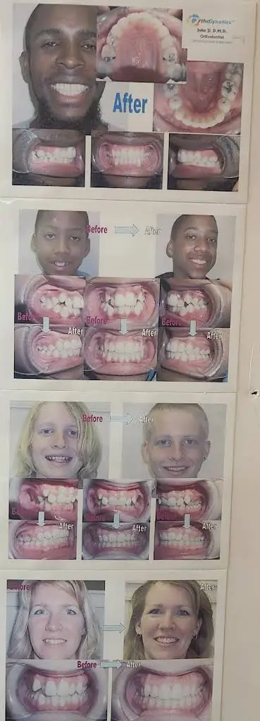 Ji Orthodontics