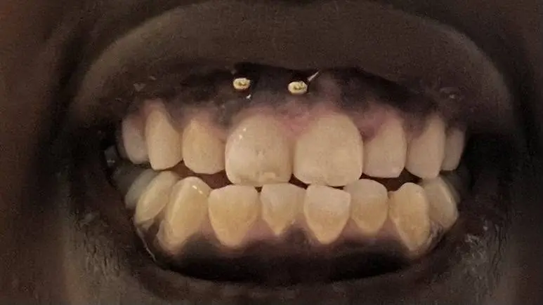Petersburg Family Dental
