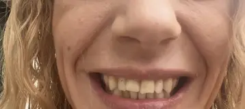 Dental First PLC